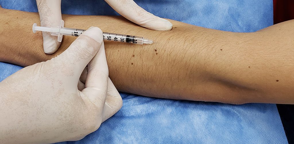 Prueba de PPD mantoux